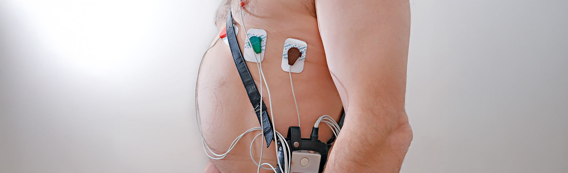 Cardiac monitoring