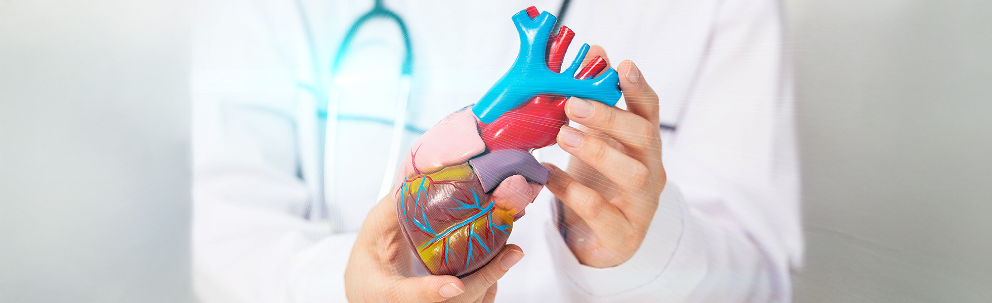 Coronary angioplasty